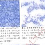 犬淋巴瘤