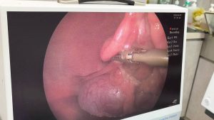 母狗腹腔鏡微創絕育手術方式跟恢復時間